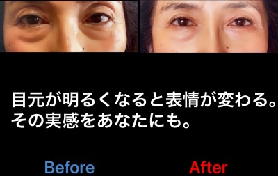 103021A8-7E70-4056-990E-7B179F9AFBA4