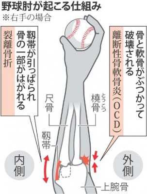 hijino
