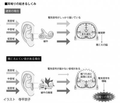 耳鳴り3