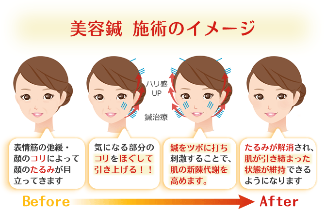 鹿児島 日置市 いちき串木野市 美容鍼灸するなら はりきゅう院だん はりきゅう院だん