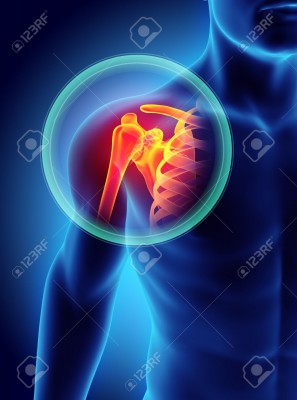 Shoulder painful skeleton x-ray, 3D illustration.