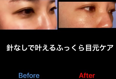 7B4BD317-4B11-4EED-9615-6DE7A3A8A024