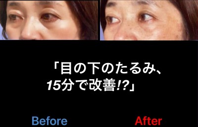 FE132887-C53F-4729-B8F5-38F6C13FA332
