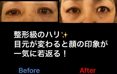 81A4C9BD-3166-43A5-BECA-10A7888DC64D