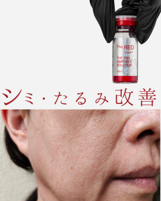 37920025-4FF8-4E51-AB54-0EED9F3DFB2E