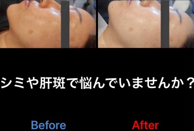 FCB58761-05C8-47D7-8FC2-55D965DB5447